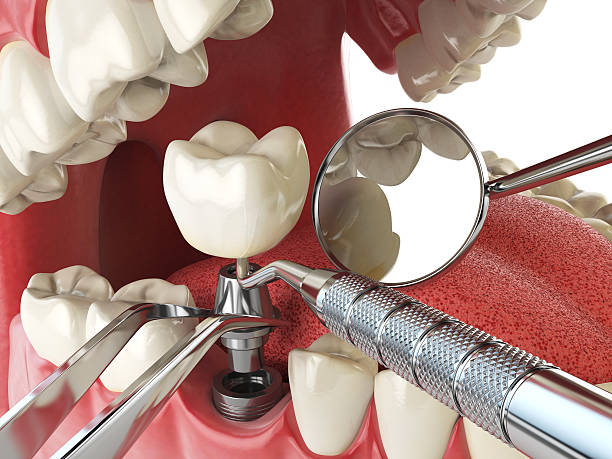 Best Cracked Tooth Emergency Dentist  in Brownsboro, TX